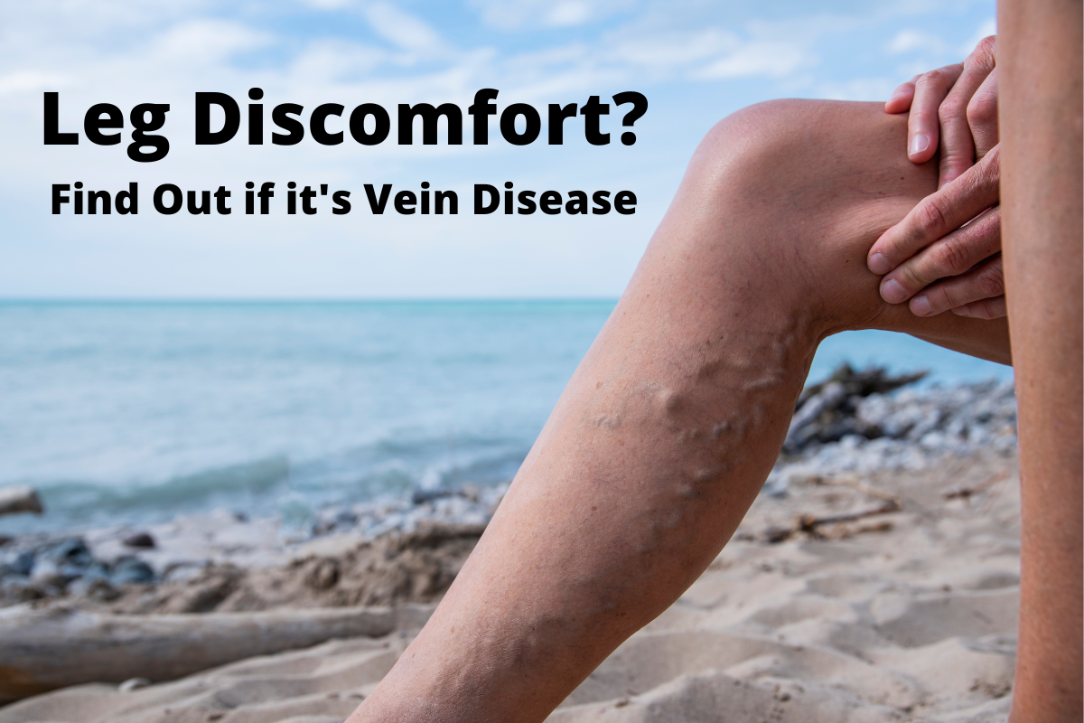 Top 3 Signs of Vein Disease